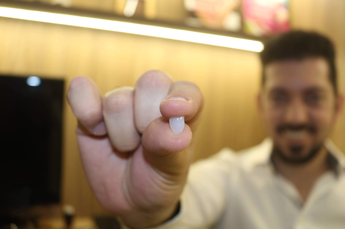 Dr. Leonardo Reberte, dentista em Guarulhos, segurando uma lente de contato dental